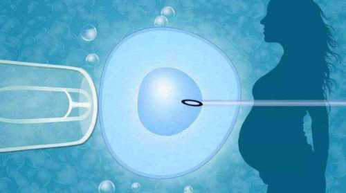 专业试管婴儿费用详解与调理指南